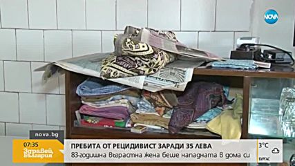 От първо лице: Зверски пребитата жена от Гурково разказва за ужаса от преживяното