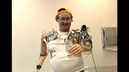 Bionic Hand - Jesse Sullivan 