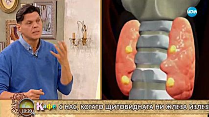 Доктор Гайдурков дава съвети с решения на проблемите с щитовидната жлеза - На кафе (23.01.2018)