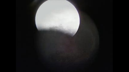 Eclipse De Luna Total