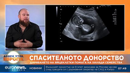 Около 8000 лв. струва донорската процедура на яйцеклетки