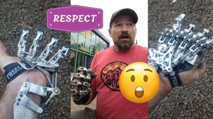 Мъж си създаде собствена бионична ръка?