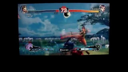 Ssf4 - lyte edge (chun Li) vs Axis (ibuki) - Gaf Xbl 3 vs 3 Team Tourney - Set 2 - - 