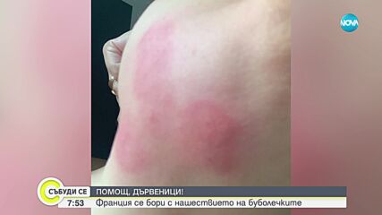 Нашествие от дървеници във Франция, буболечките ужасяват пътници в обществения транспорт