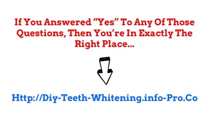 Teeth Whitening Kits, Led Teeth Whitening, Teeth Whitening Pens, Smile Bright Teeth Whitening