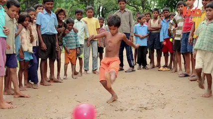 Момчето с осем крайника от Индия - История с щастлив край
