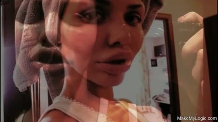 Another Super Pretty Victim Of Plastic Surgeons _