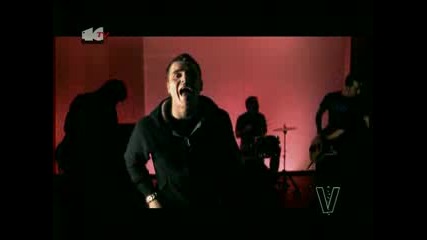 El Canto Del Loco - Insoportable 