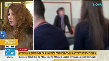 Счупен нос, избит зъб и рана на окото: Пореден случай на агресия между ученици