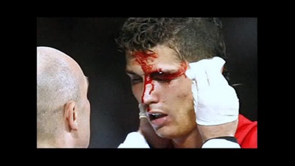 Cristiano Ronaldo кърви