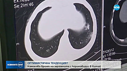 Директор на болница в Ухан почина от коронавируса