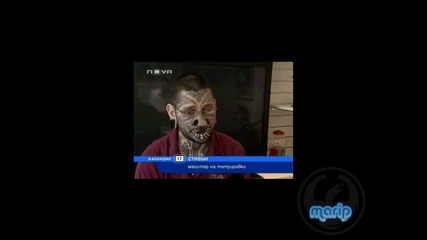 Момиче се сдоби с 56 звездички по лицето
