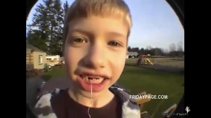 Момче си вади зъб с помощта на ракета