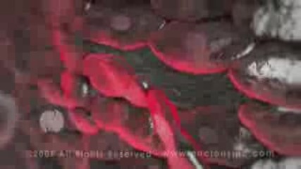 Amazing 3d Medical Animation