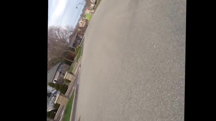 Kid breaks ankle on scooter