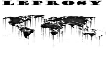 Leprosy Face of dead 2019