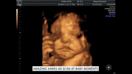 Amazing 4d baby scan http://www.scan4d.co.uk/ call 08000075076