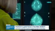 Ранната диагноза спасява живот: Безплатни прегледи за рак на гърдата до края на октомври