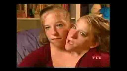 Abigail and Brittany Hensel Due Ragazze con un corpo solo.avi