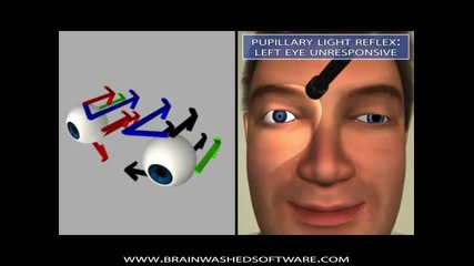 The Oculomotor Nerve in 3d