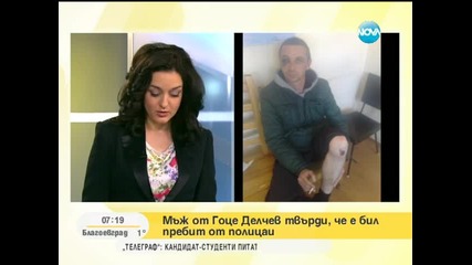 34-годишен мъж се оплака от полицейско насилие
