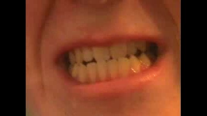 как даси направим зъбите бели
