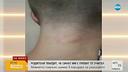 Родители твърдят, че синът им е бит от учител