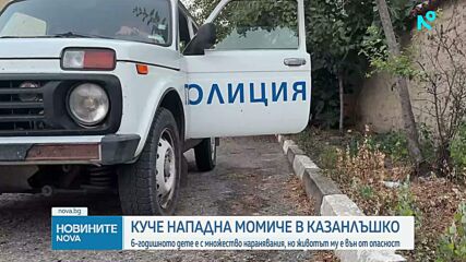 Какво е състоянието на момичето, нападнато от Кане Корсо