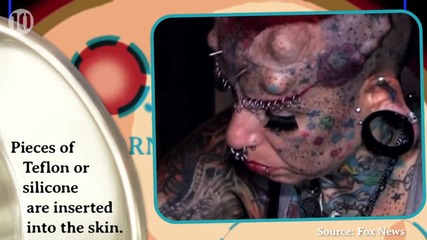 Bizarre Cosmetic Procedures -
