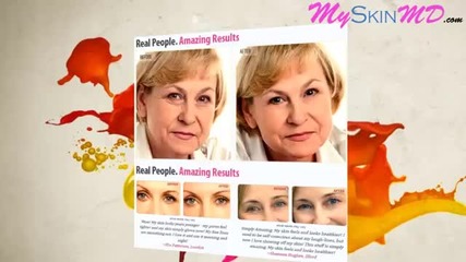 Juvesiio Anti-wrinkle Serum Review - Is Juvesiio Anti-wrnkle Serum A Scam?