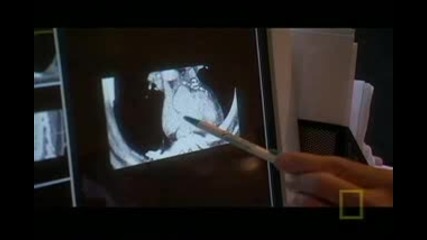 Ngs - Building Big Steroids Use - 3(3 Of 5)