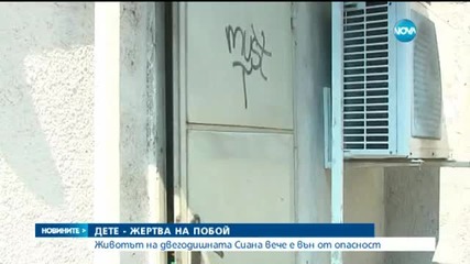 Имало е системно насилие над пребитото 2-годишно дете