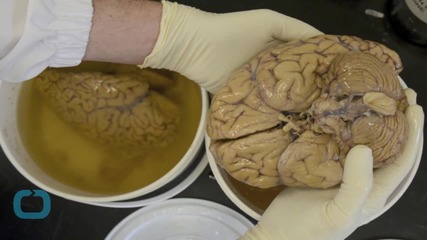 Did Eating Brains Help Tribe Become Disease Resistant?