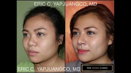 Plastic and Cosmetic Surgery - Theiconclinic