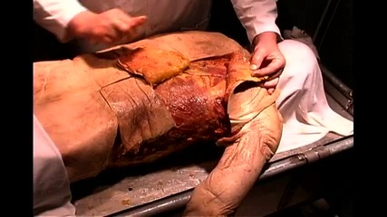 1. Повърхностна анатомия на гръден кош и корем