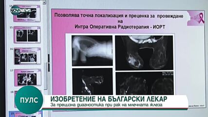 "Пулс": Български лекар изобрети прецизна диагностика за рак на гърдата