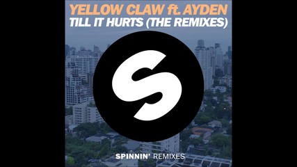 Yellow Claw ft. Ayden - Till It Hurts (mr. Belt & Wezol Remix)