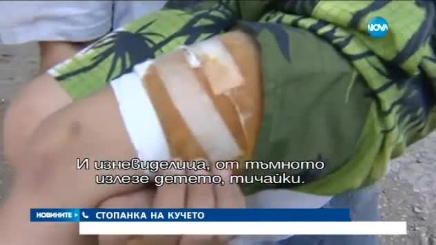 7-годишно момче нахапано от питбул - Новини