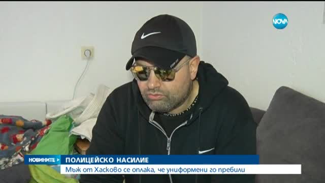Мъж от Хасково се оплака от полицейско насилие
