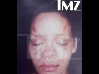 Шокираща Снимка На Rihanna След Инцидента С Chris Brown!