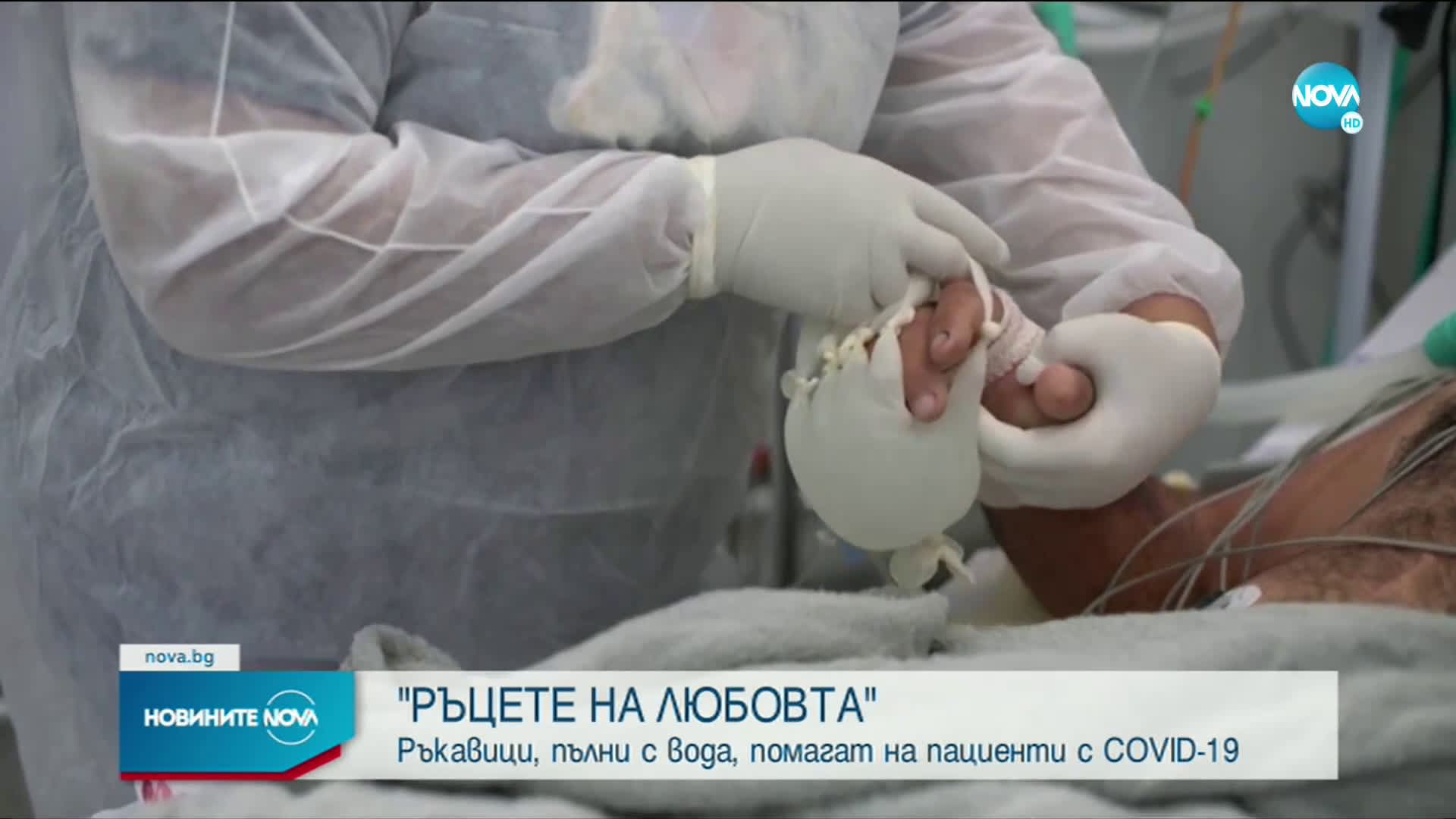 РЪЦЕТЕ НА ЛЮБОВТА: Ръкавици, пълни с вода, помагат на пациенти с COVID-19