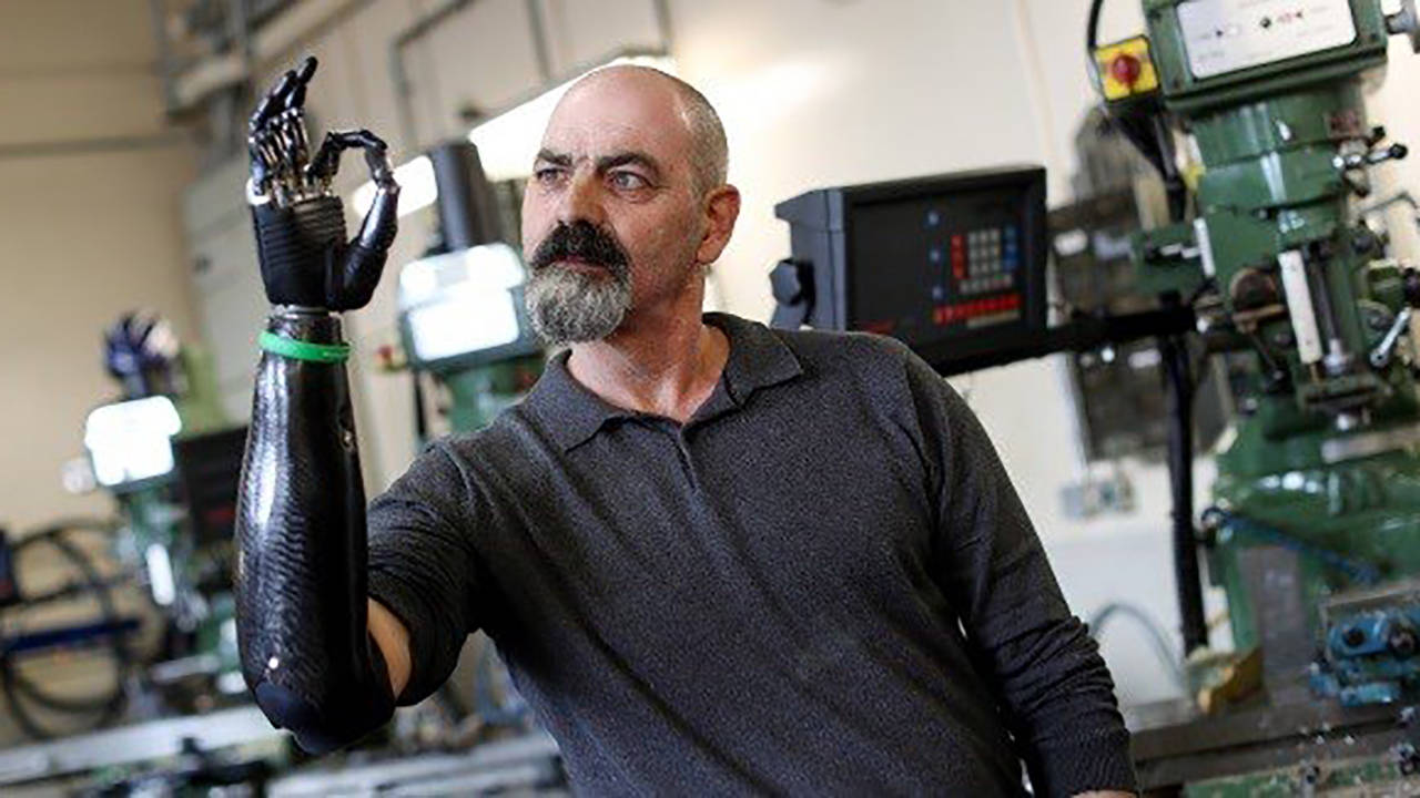 Бъдещето е тук: Как мъж живее с роботизирана ръка