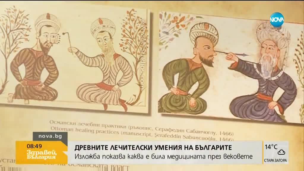 Древните лечителски умения на българите: Изложба показва медицината през вековете