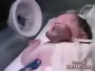 Уникално !!! Бебе Родено Със Сърце Извън Тялото