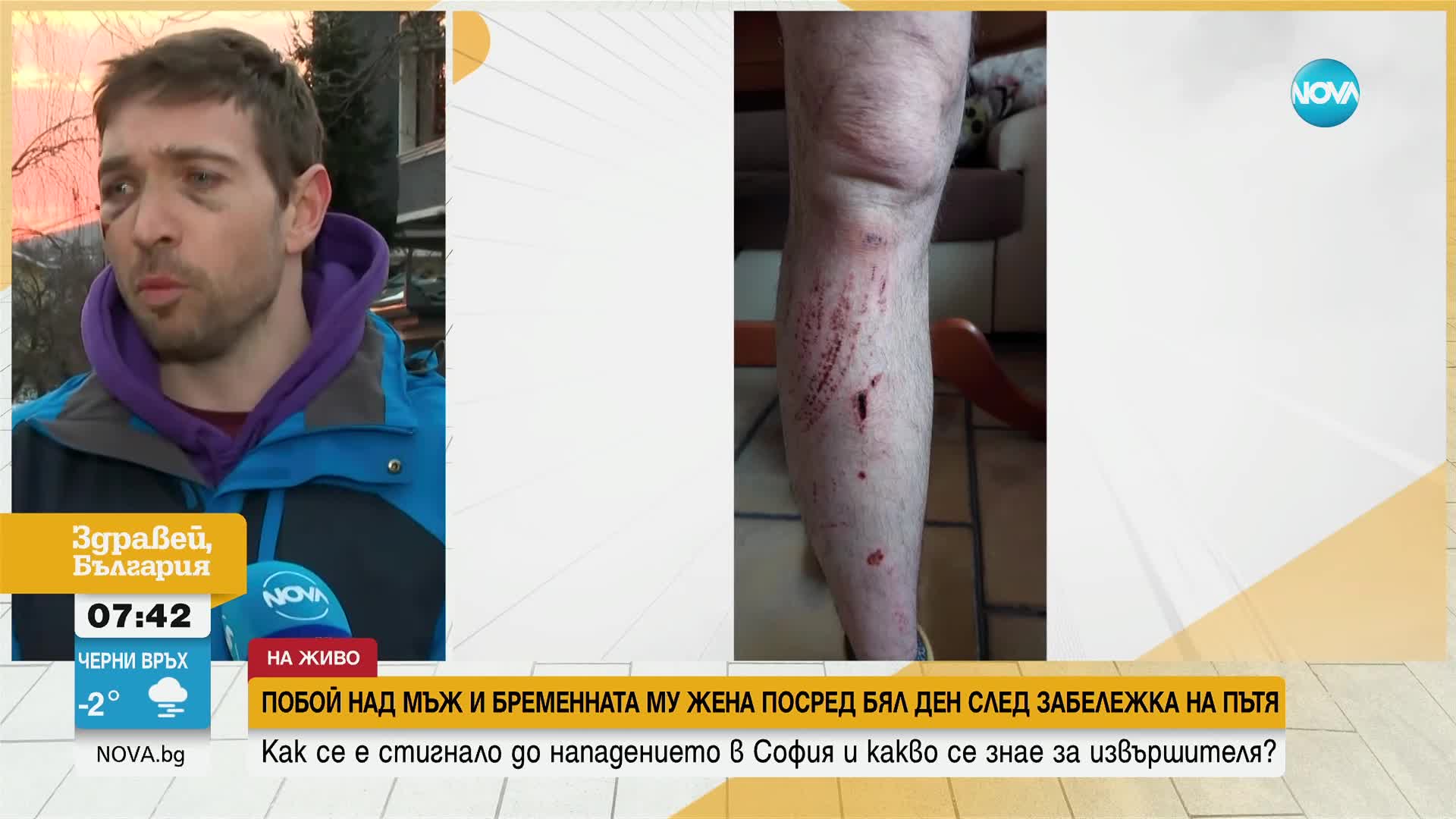 Мъж твърди, че е бит пред бременната си жена след забележка на пътя