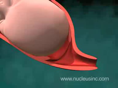 3d Анимация На Нормално Вагинално Раждане