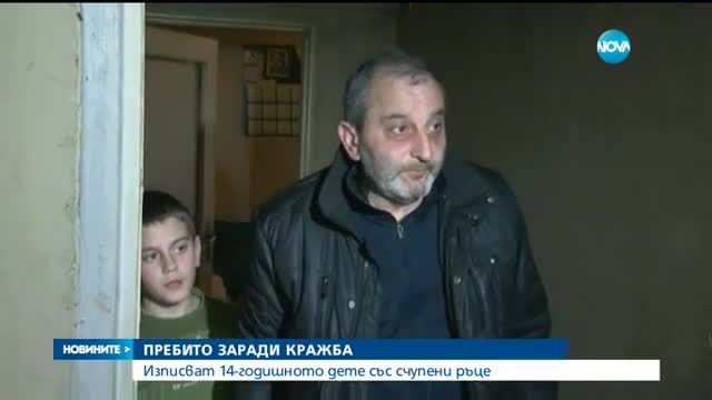 Изписаха от болница детето, на което му счупиха ръцете заради кражби