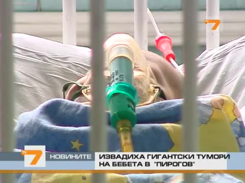 Извадиха гигантски тумори на бебета в Пирогов 
