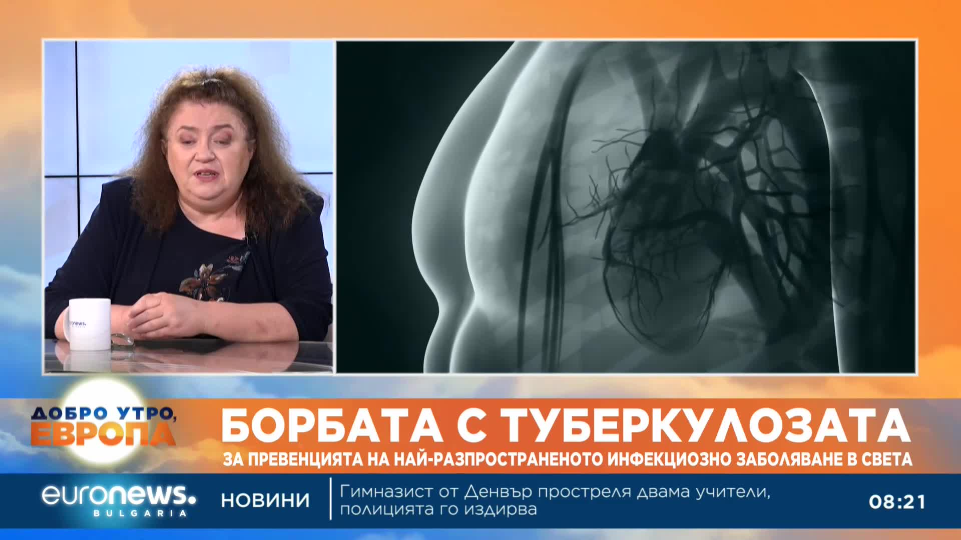 Вирусолог: Над 10 млн. души годишно заболяват от туберколоза