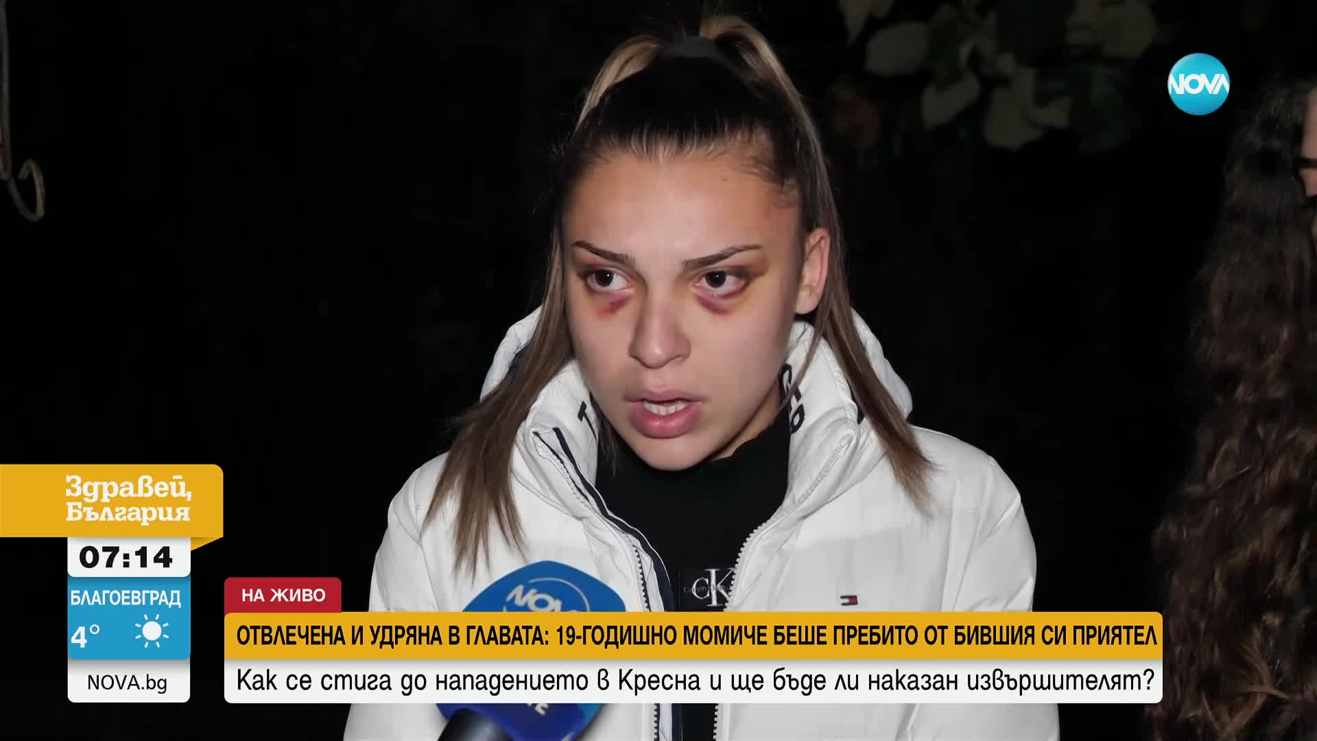 „Казваше, че ще умра в този момент“: Млада жена беше жестоко пребита от бившия ѝ приятел